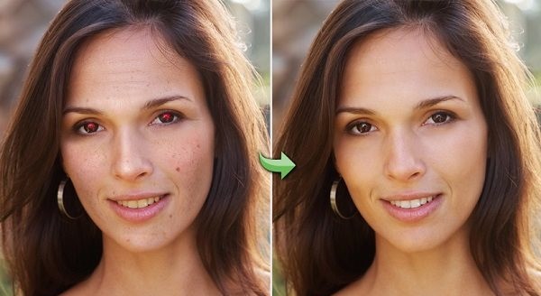 Photo Blemish Remover(照片美化软件)下载 v2.0.1官方版  (2)
