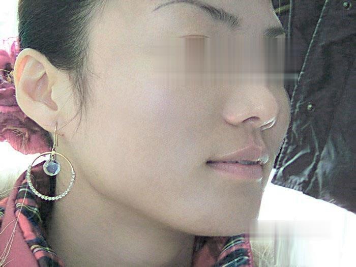 ps怎么给图片去除痘印(9)