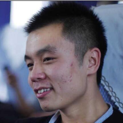 ps如何给人物照片磨皮祛痘(3)