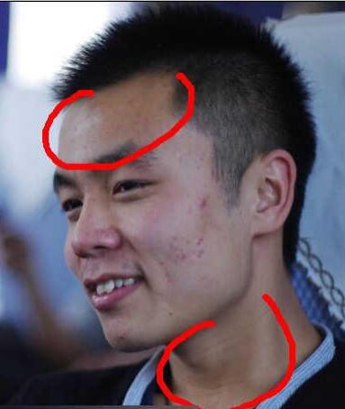 ps如何给人物照片磨皮祛痘(2)