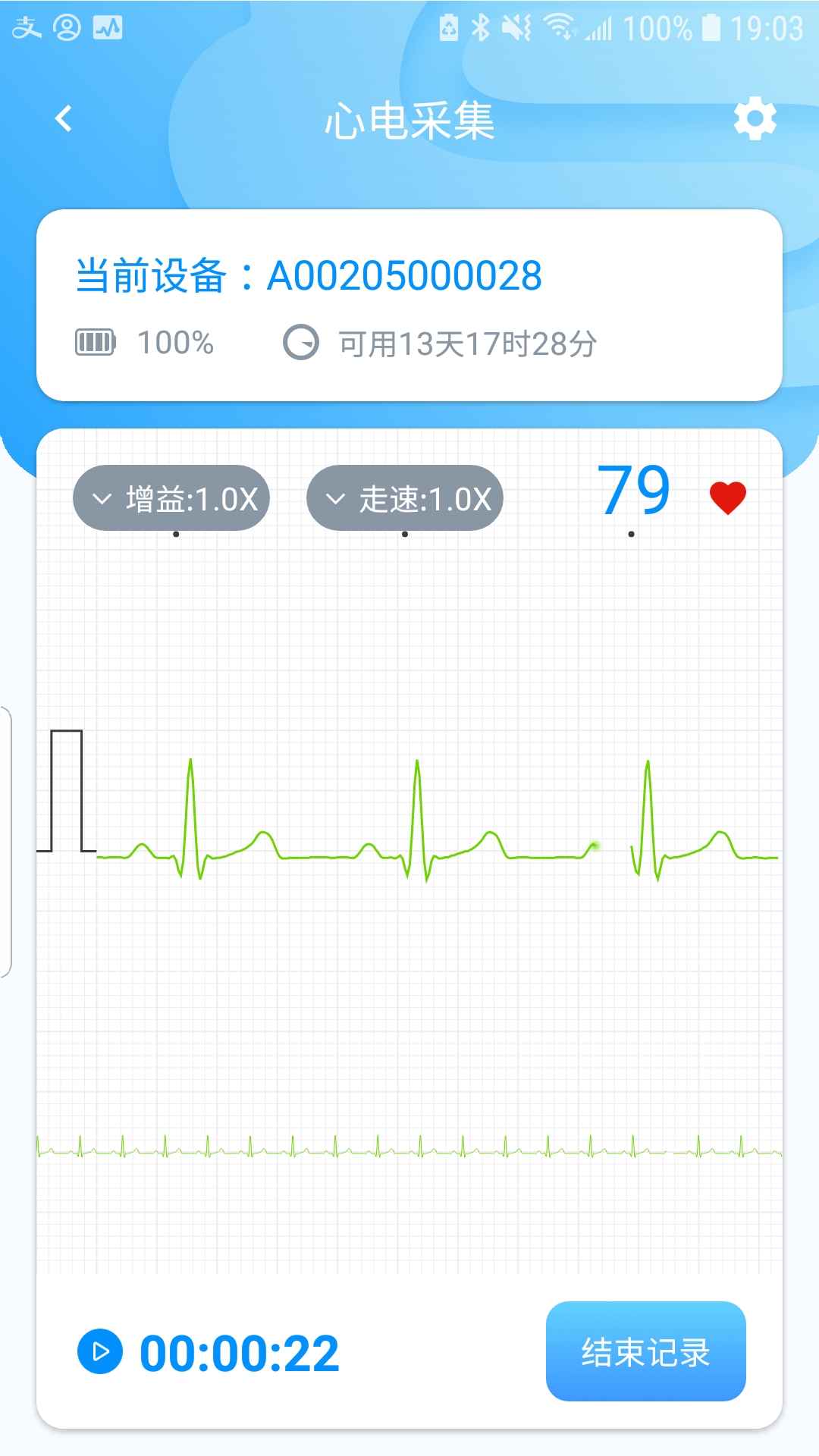 星康心电(心电监测)