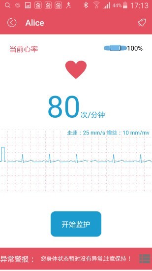 SMART ECG