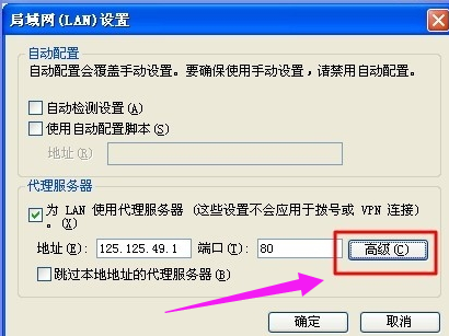 win7电脑如何隐藏ip地址(4)